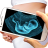 icon Ultrasound Scanner 1.26